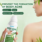 Sumifun Body Acne Care Spray 100ml | Tea Tree Body Spray | Back, Chest & Shoulder Skin Care Spray | Daily Body Care Formula