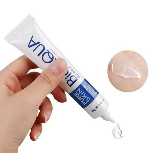 Bio Aqua Acne Cream Face Skin Care Acne Anti-Wrinkle Removal Cream Spots Scar Blemish Marks 30g