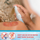 Sumifun Burn & Scald Cooling Spray 30ml | Herbal Skin Cooling Spray | First Aid Skin Care Spray | Daily Skin Care Formula