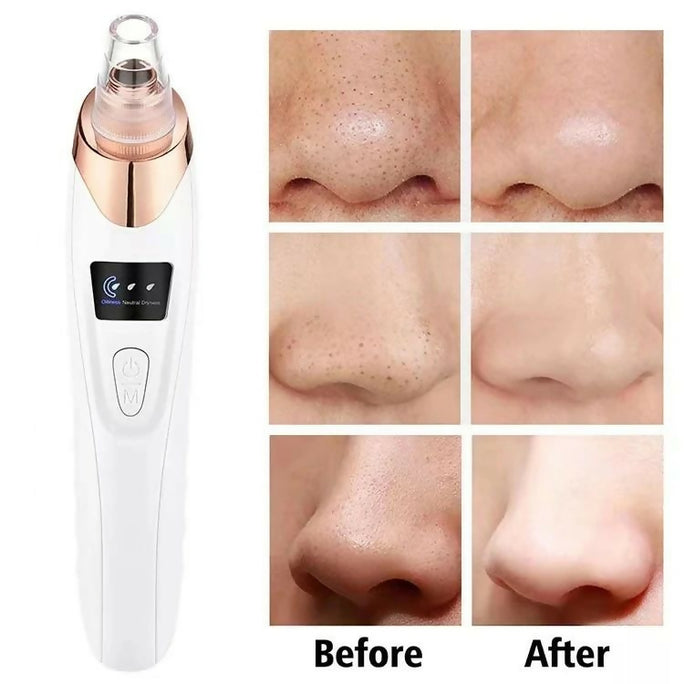 Upgraded Blackhead Remover Vacuum Facial Pore Cleaner Electric Acne Comedone Whitehead Extractor Tool 5 Probes For Women And Men