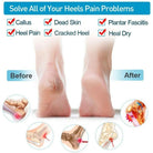 Silicone Heel Pads, Anti Crack Heel Protector, Heel Protectors Set, Silicone Half Heel Anti Crack Covers, Silicone Moisturizing Gel Heel Anti-Crack Socks