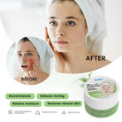 Sumifun Seborrheic Care Cream 30g | Moisturizing Skin Care Cream for Dry, Flaky & Sensitive Skin | Face & Scalp Care