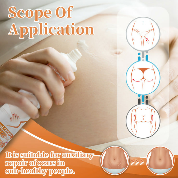 Sumifun Stretch Marks Removal Cream 20g | Herbal Skin Care Cream | Skin Elasticity & Body Care Formula | External Use