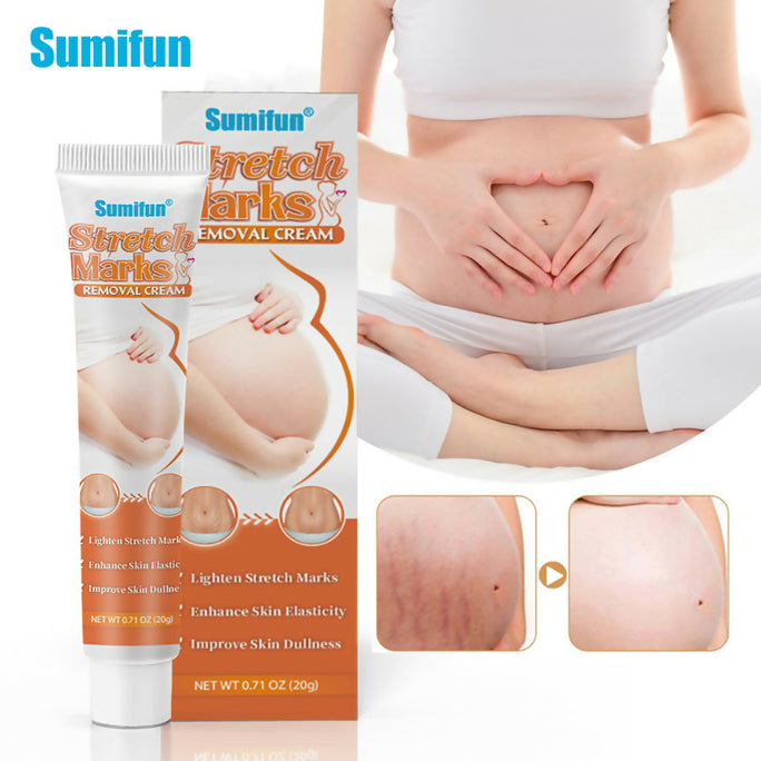 Sumifun Stretch Marks Removal Cream 20g | Herbal Skin Care Cream | Skin Elasticity & Body Care Formula | External Use