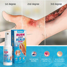 Sumifun Burn & Scald Cooling Spray 30ml | Herbal Skin Cooling Spray | First Aid Skin Care Spray | Daily Skin Care Formula