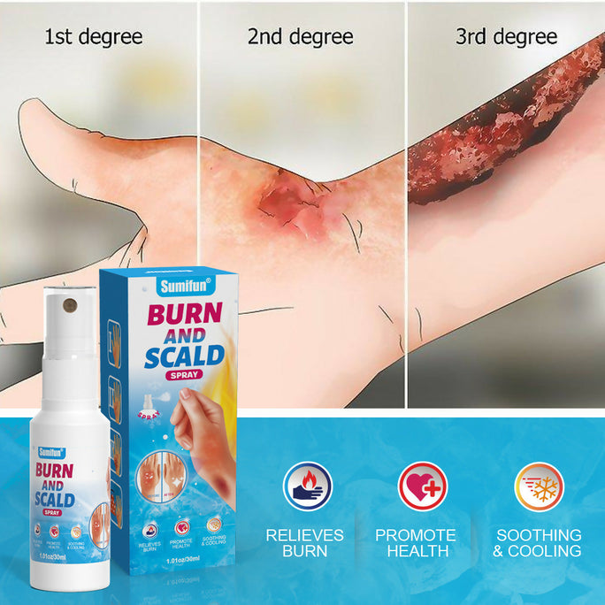Sumifun Burn & Scald Cooling Spray 30ml | Herbal Skin Cooling Spray | First Aid Skin Care Spray | Daily Skin Care Formula