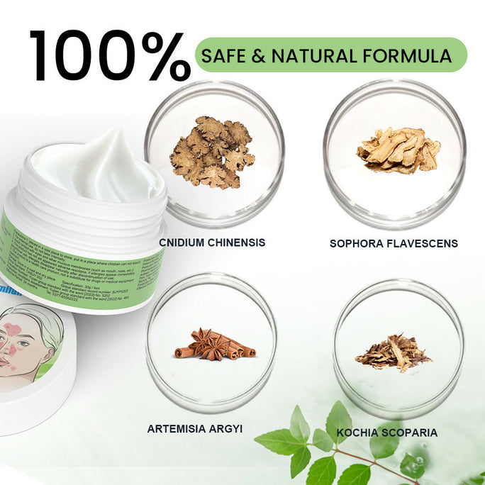 Sumifun Seborrheic Care Cream 30g | Moisturizing Skin Care Cream for Dry, Flaky & Sensitive Skin | Face & Scalp Care
