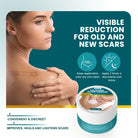 Sumifun Silicone Scar Cream 30g | Scar Care Cream | Moisturizing Skin Care Cream for Face & Body | Silicone Gel Formula
