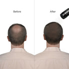 Caboki Hair Building Fibers Makes thin hairs thick everyday (27.5gm - Black)