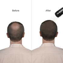 Caboki Hair Building Fibers Makes thin hairs thick everyday (27.5gm - Black)