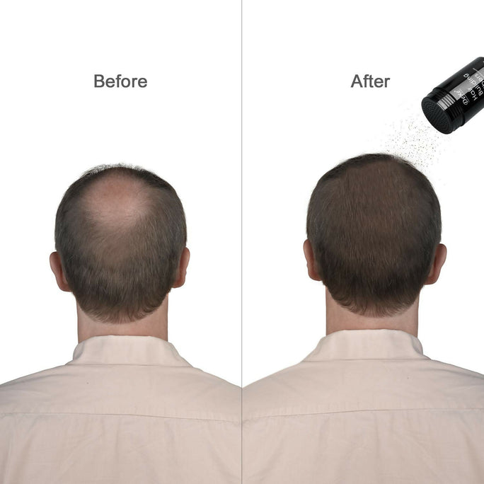 Caboki Hair Building Fibers Makes thin hairs thick everyday (27.5gm - Black)