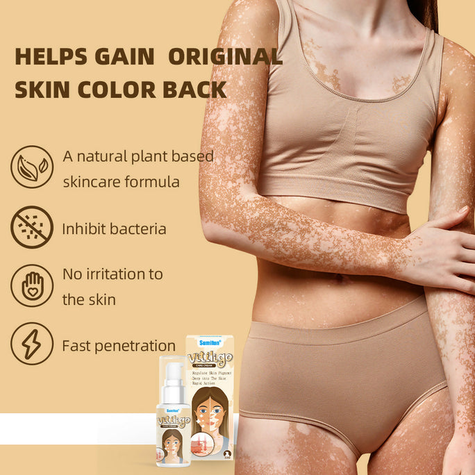 Sumifun Vitiligo Care Cream 30ml | Pigmentation Care Cream | Botanical Skin Care Formula | Daily Skin Care | External Use