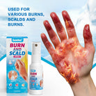 Sumifun Burn & Scald Cooling Spray 30ml | Herbal Skin Cooling Spray | First Aid Skin Care Spray | Daily Skin Care Formula