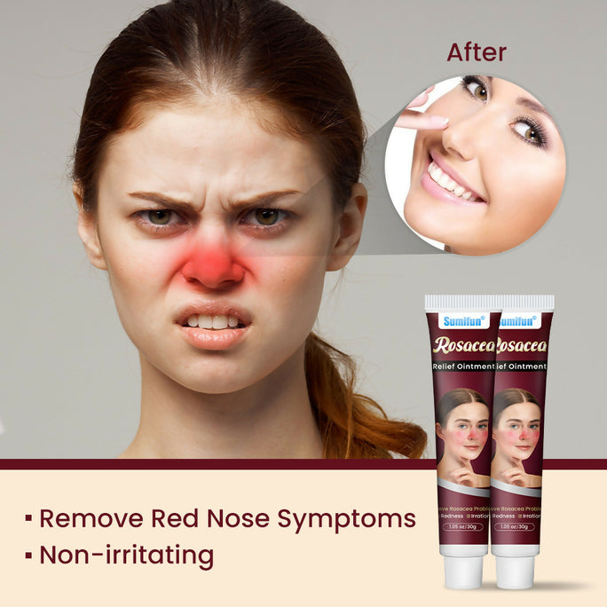 Sumifun Redness Relief Face Cream 30g | Soothing Facial Moisturizing Cream | Daily Skin Care Cream for Sensitive Skin