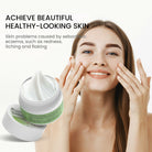Sumifun Seborrheic Care Cream 30g | Moisturizing Skin Care Cream for Dry, Flaky & Sensitive Skin | Face & Scalp Care