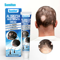 Sumifun Alopecia Hair Care Cream 20g | Botanical Scalp Care Cream | Hair Nourishing Formula | Daily External Use