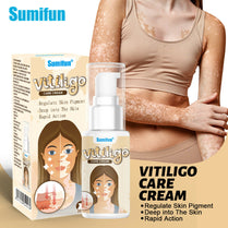 Sumifun Vitiligo Care Cream 30ml | Pigmentation Care Cream | Botanical Skin Care Formula | Daily Skin Care | External Use